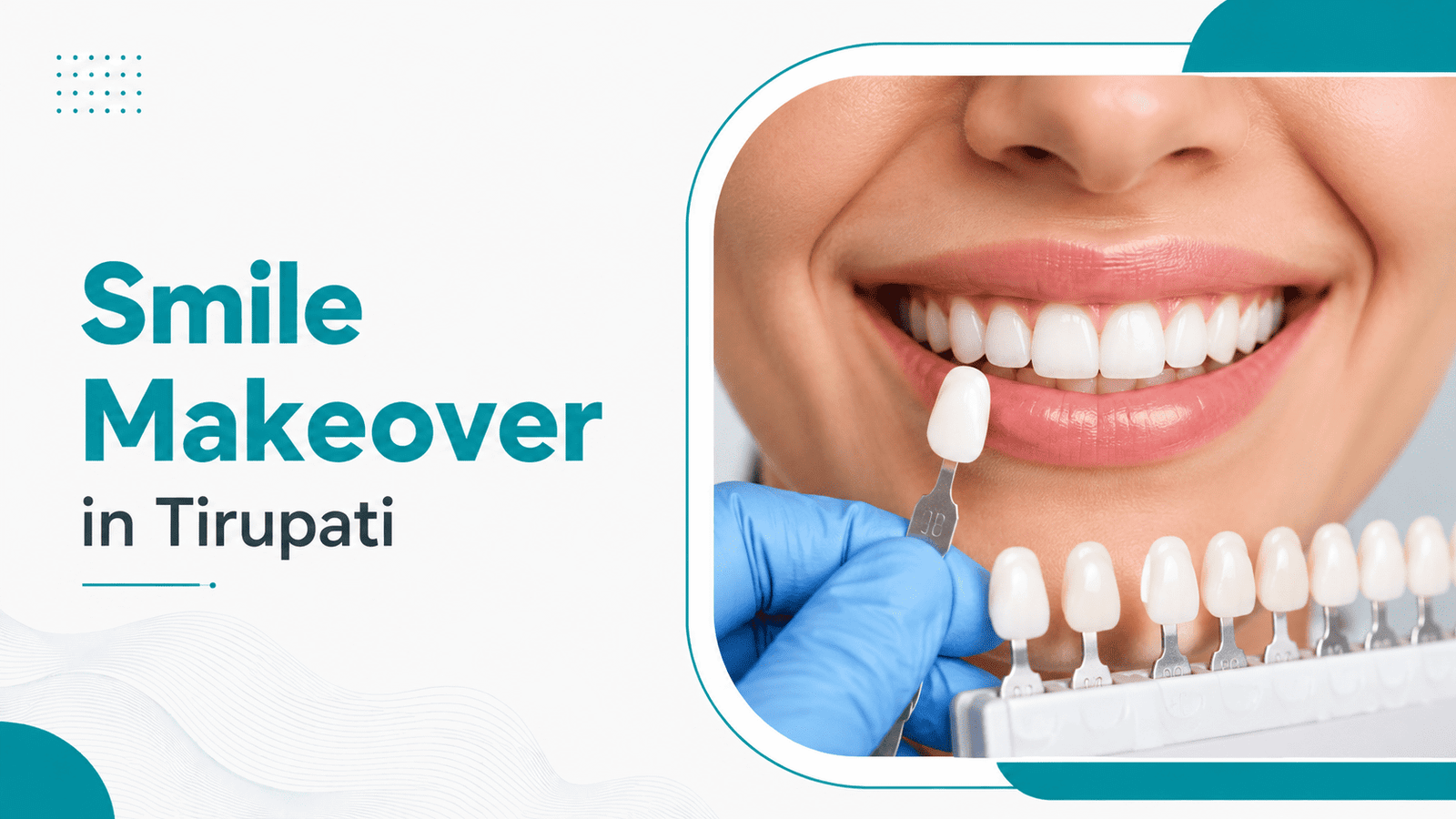Smile Makeover in Tirupati | Veneers & Smile Design
