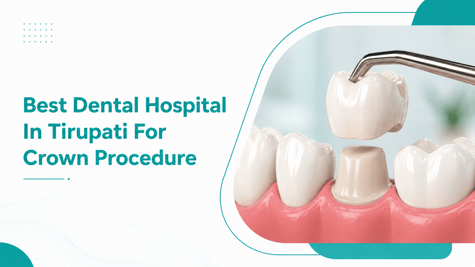 Best Dental Hospital In Tirupati For Crown Procedure