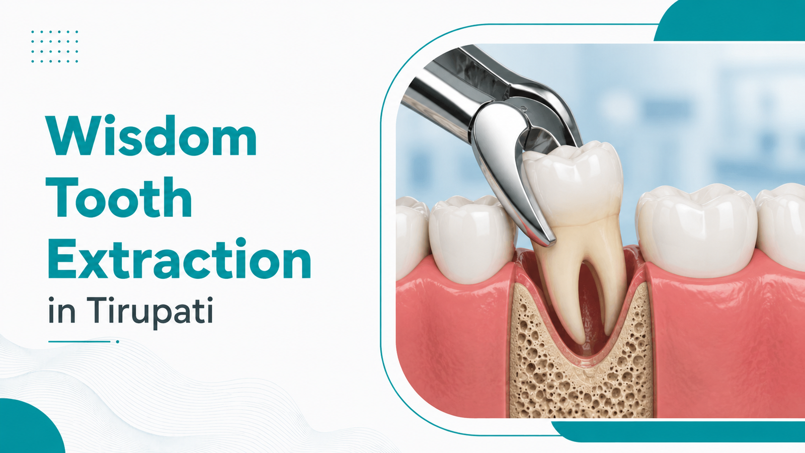 Wisdom Tooth Extraction in Tirupati: Pain, Procedure & Recovery