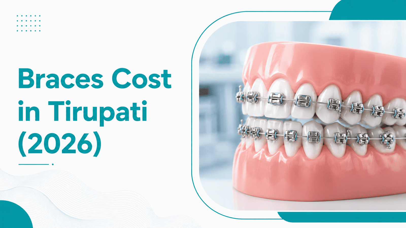 Braces Cost in Tirupati 2026 | Metal, Ceramic Price Guide 