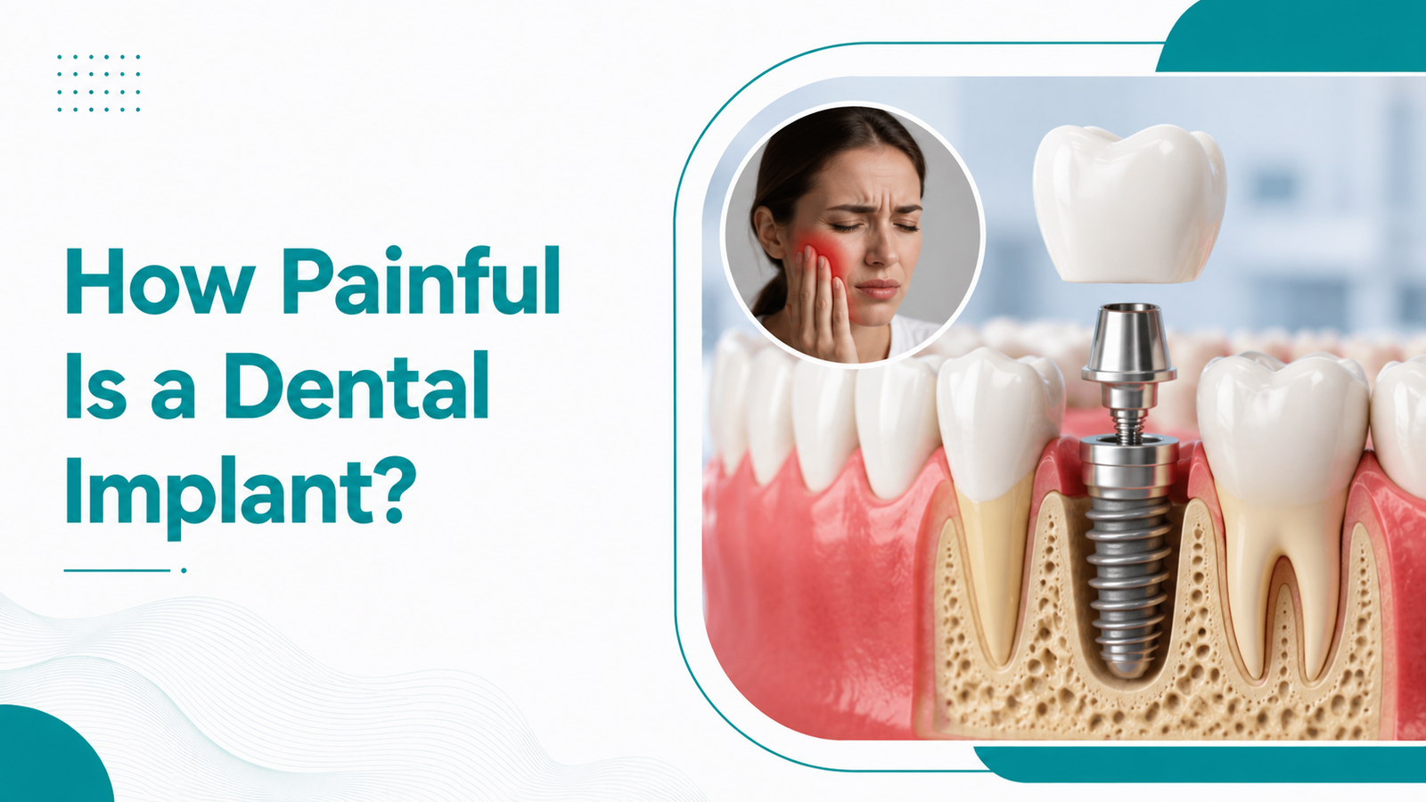 How Painful Is a Dental Implant? Honest Guide 2026