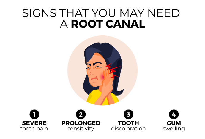 Signs that you may need a root canal