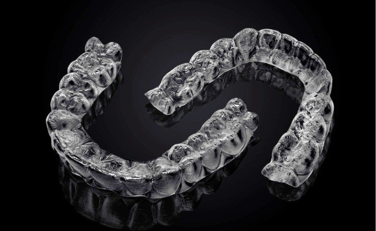 Invisalign aligner worn in the mouth — virtually invisible, smooth, and comfortable with no metal components